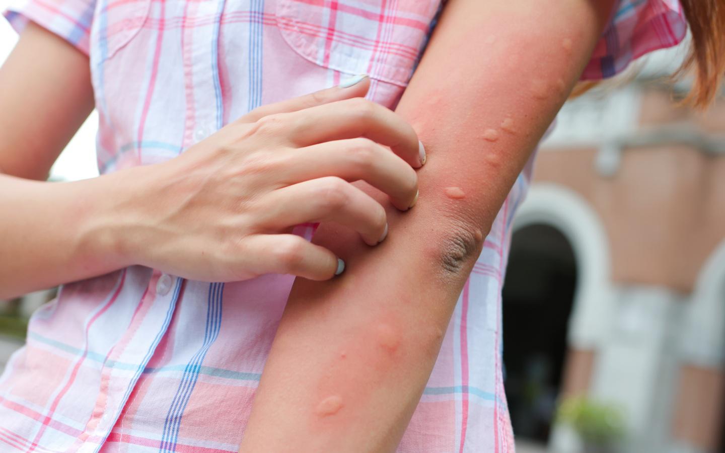 A person scratching an arm