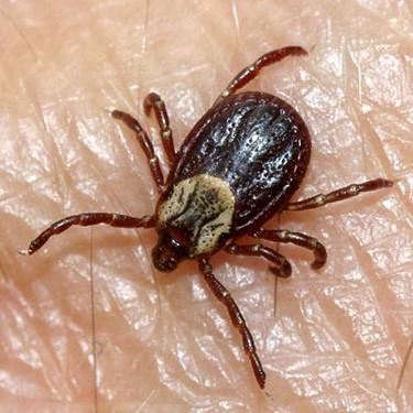 Understanding Lyme Disease